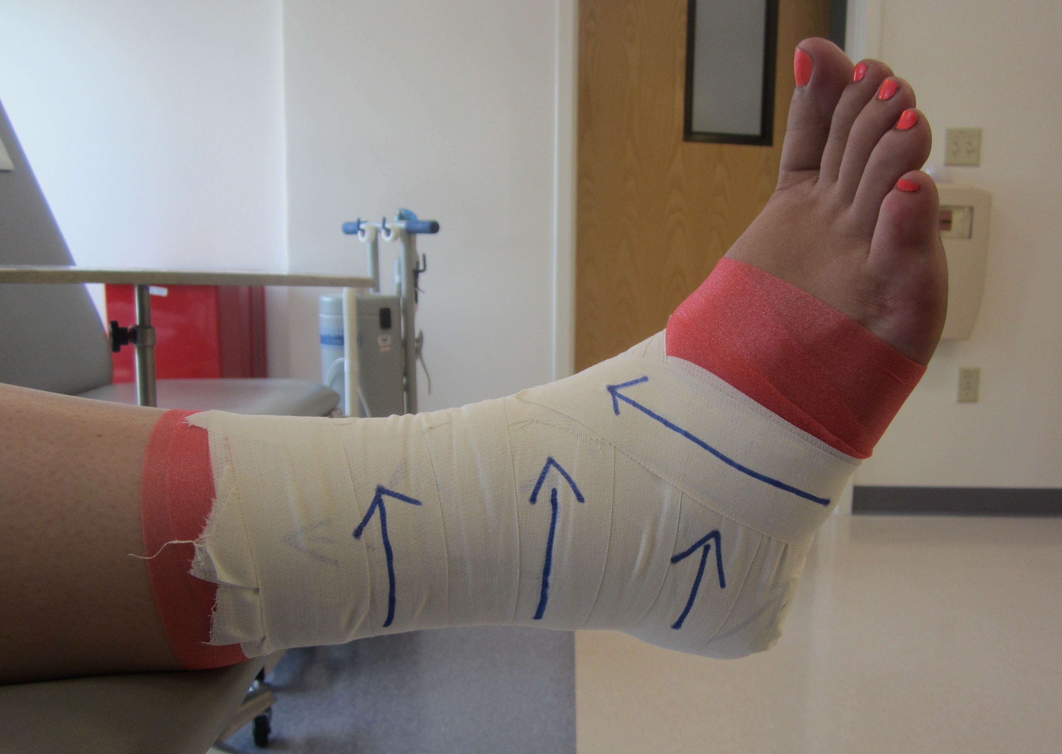 10_Ankle_Taping_Finished-Product_8.12.14.JPG