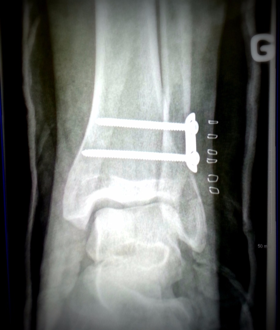 20160316_122617.jpg