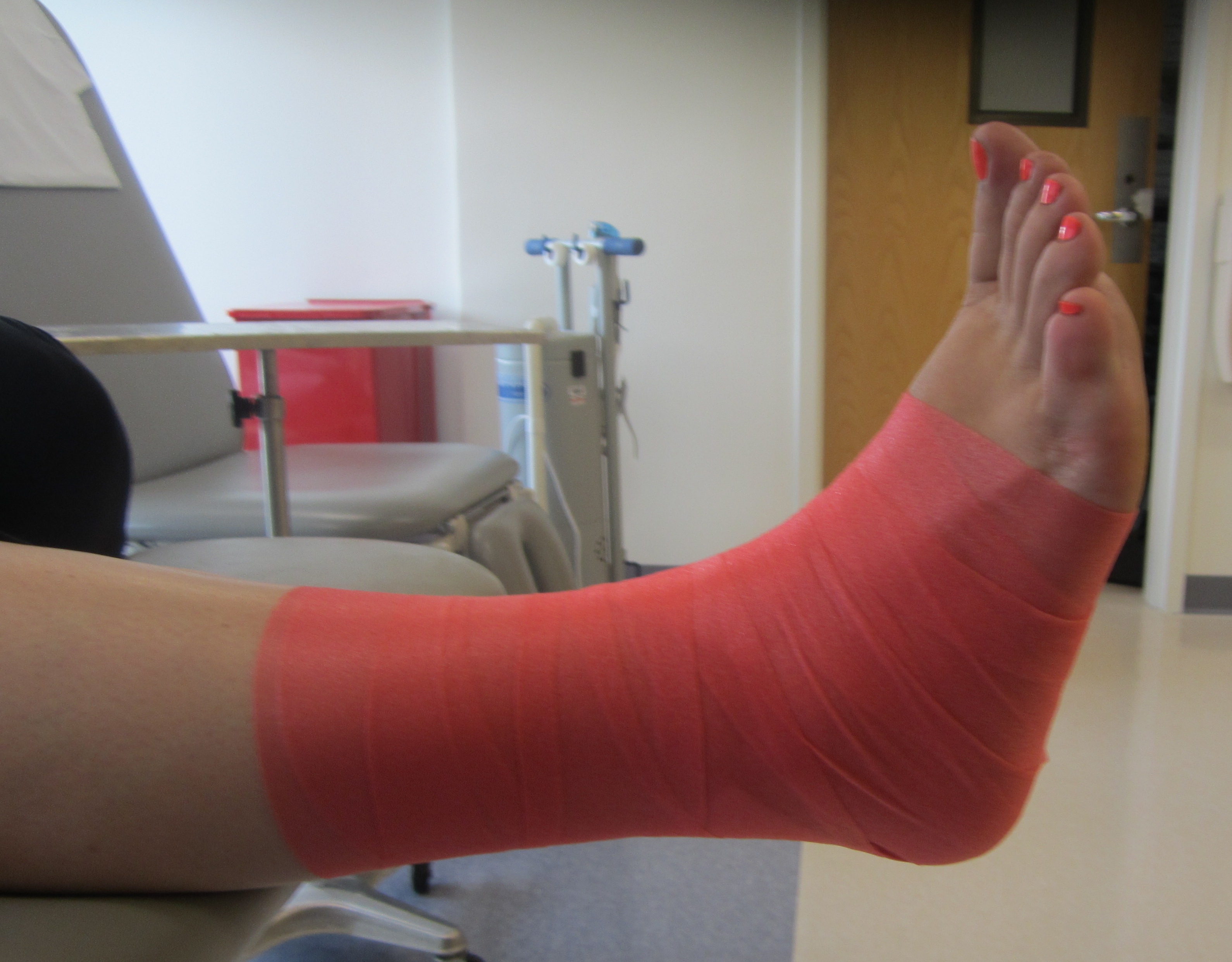 3_Ankle_Taping_PreWrap_8.12.14.JPG