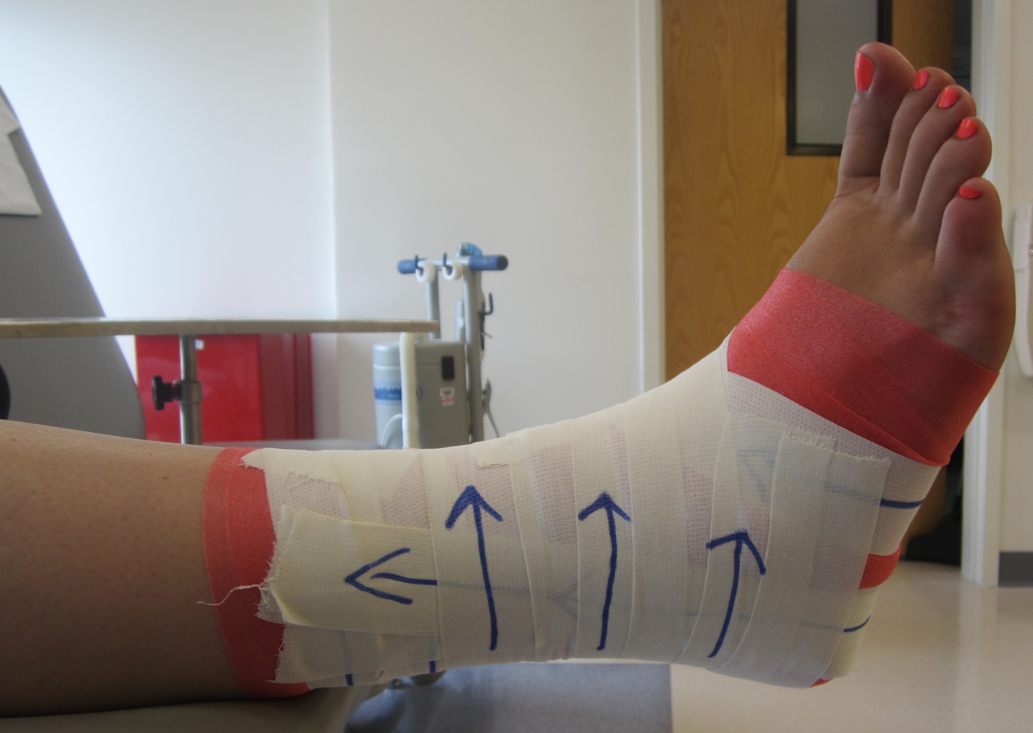 6_Ankle_Taping_8.12.14.JPG