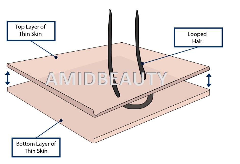 8. Infographic of V-Loop Hair Ventilating Method for Thin Skin.jpg