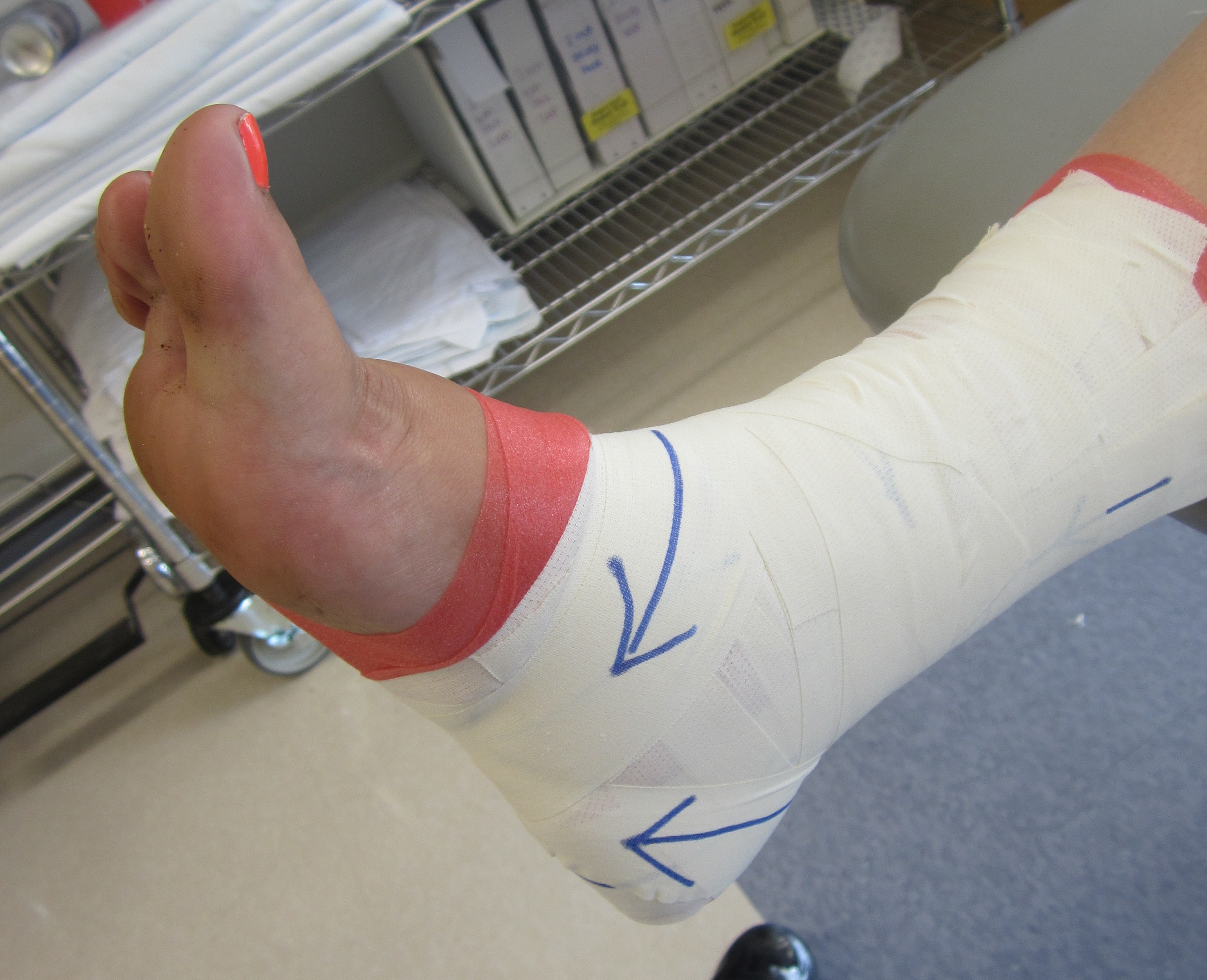 9a_Ankle_Taping_ Figure-8-(Anterior)_8.12.14.JPG