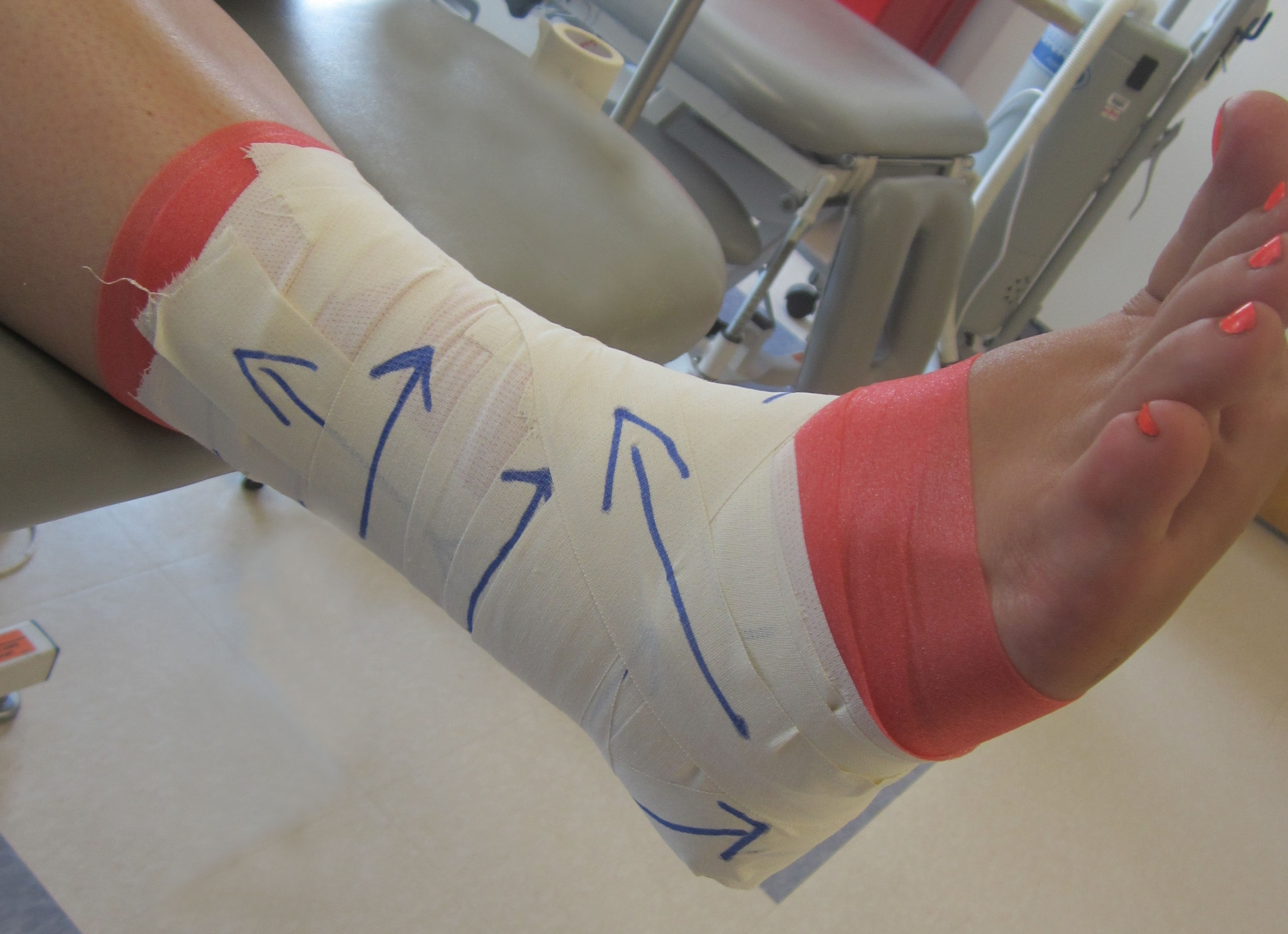 9b_Ankle_Taping_Figure_8_(Lateral)new_8.12.14.jpg