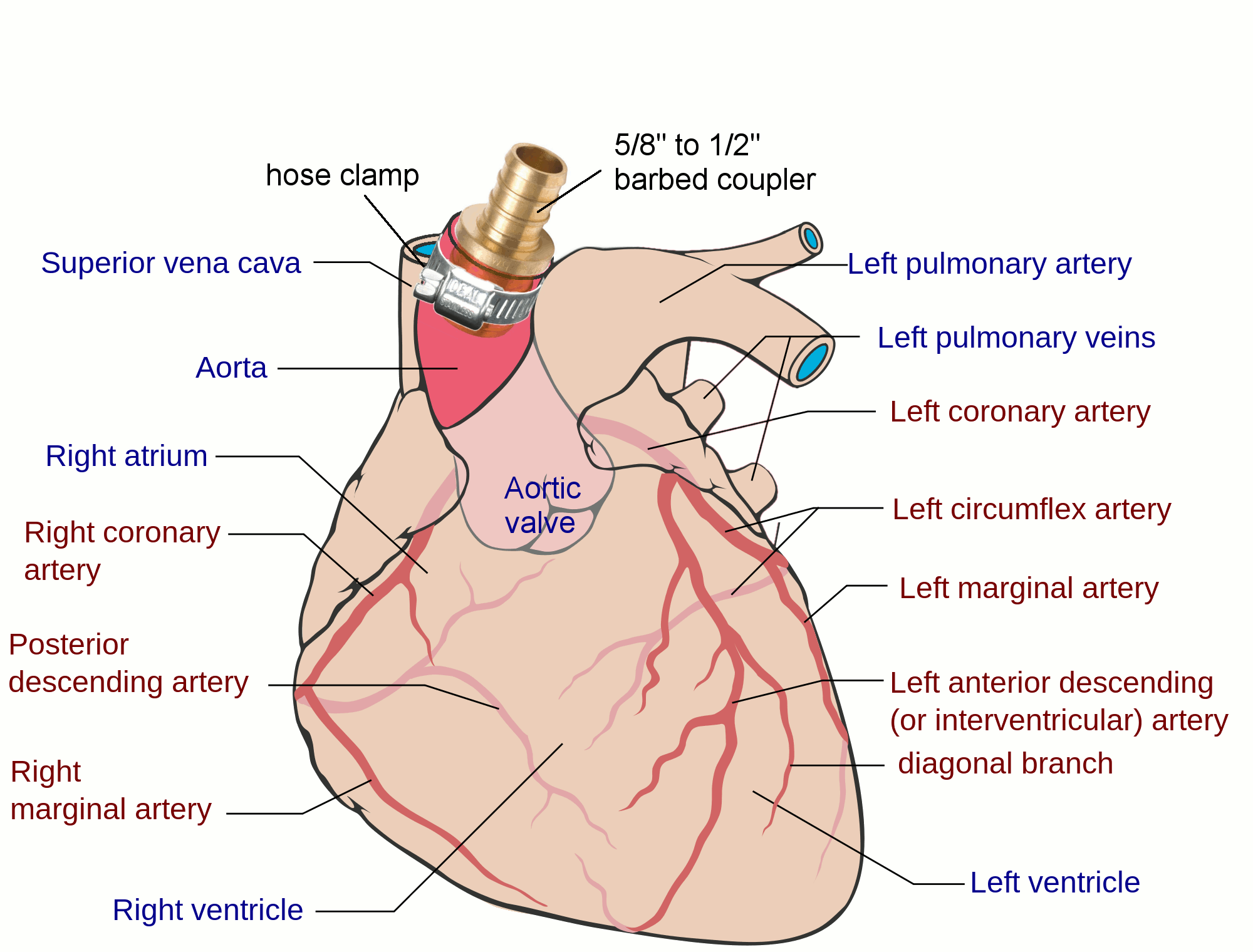 Coronary_arteries_w_coupler.gif