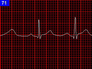 DL.PNG