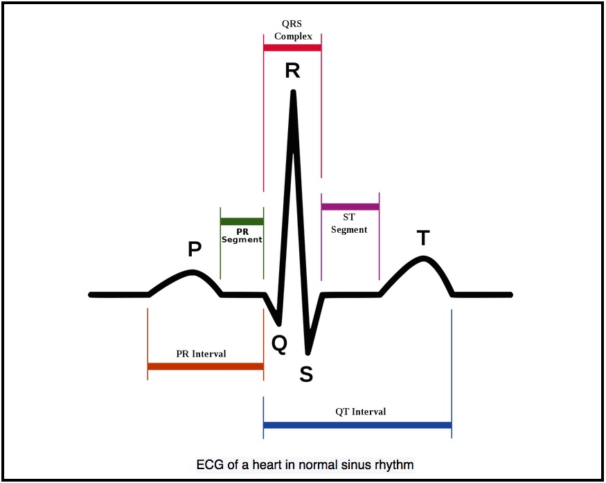 ECG Trace.jpg