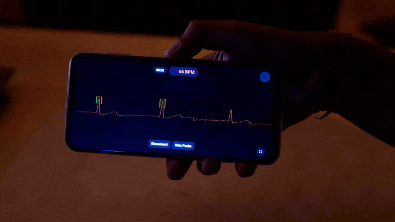 ECG monitoring on mobile phone(6).gif