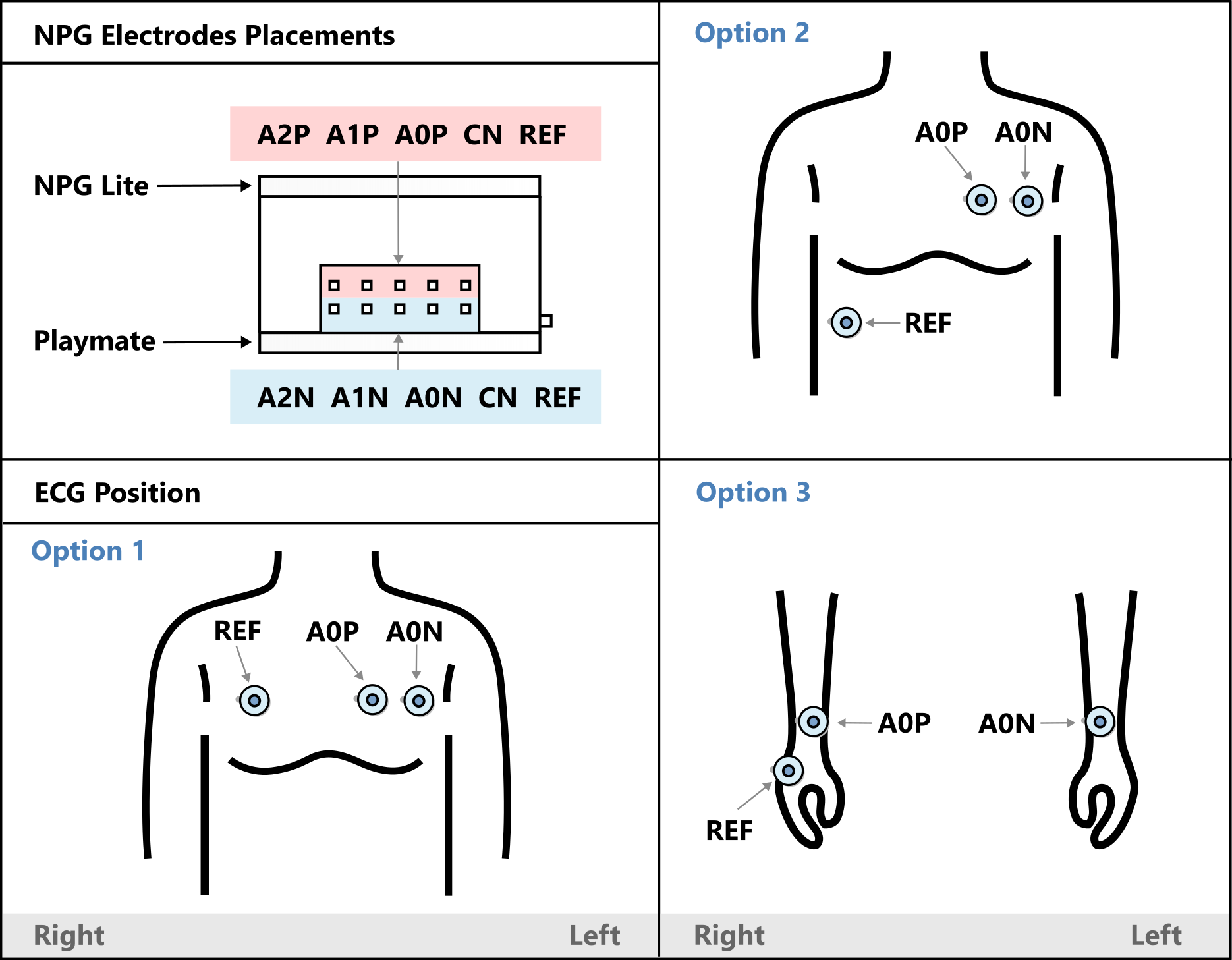 ECG.png