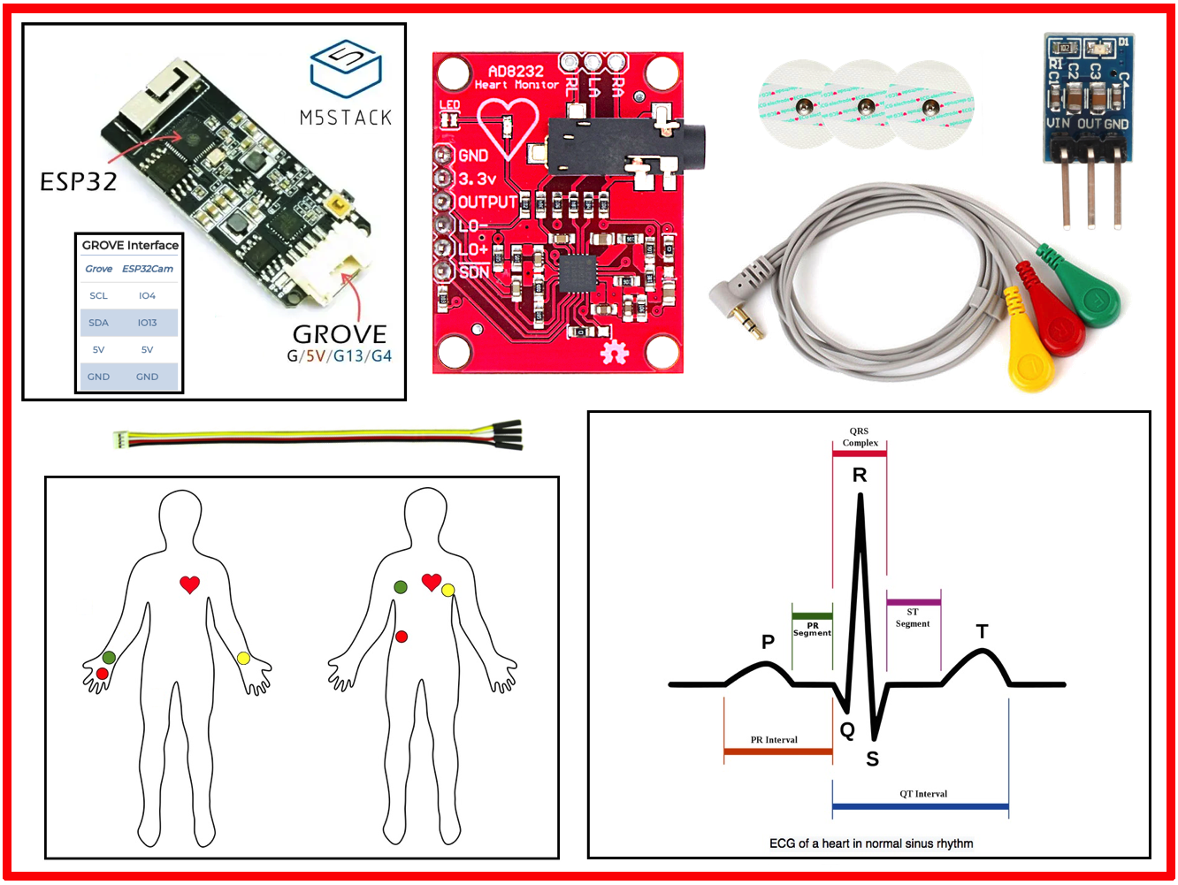 ECG.png