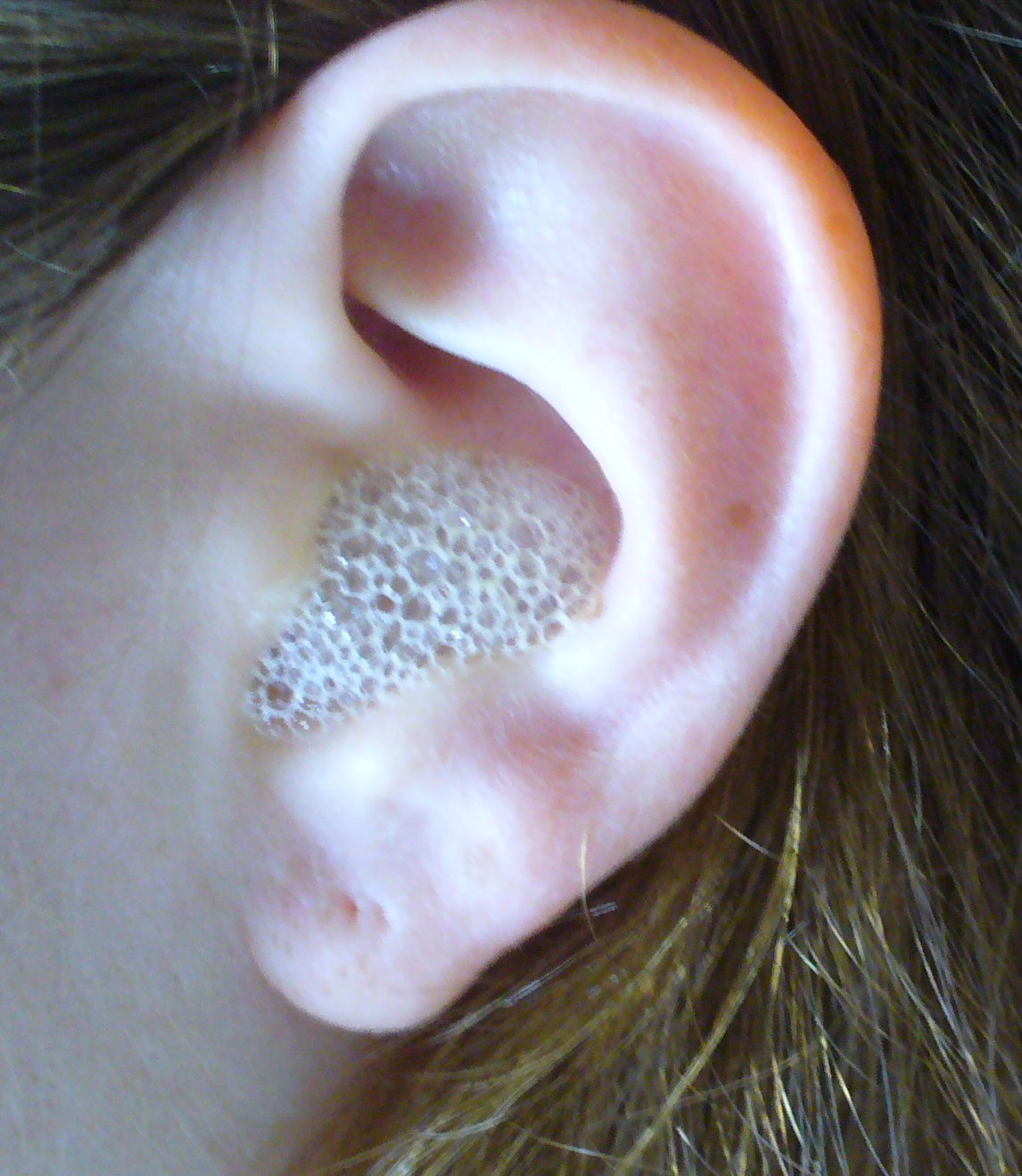 Ear Spa 040.JPG