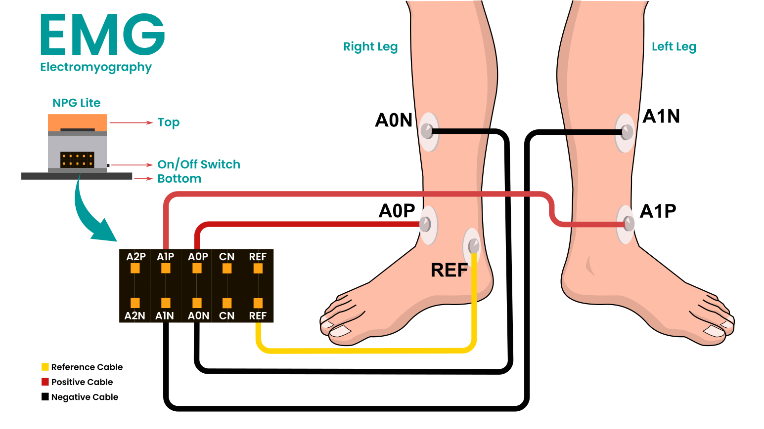 Electrodes on legs.png