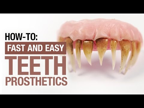 How-to: Teeth prosthetics, the simple way