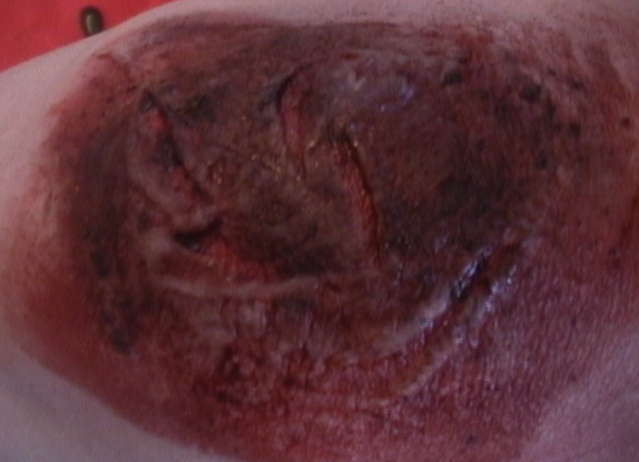 Knee.png