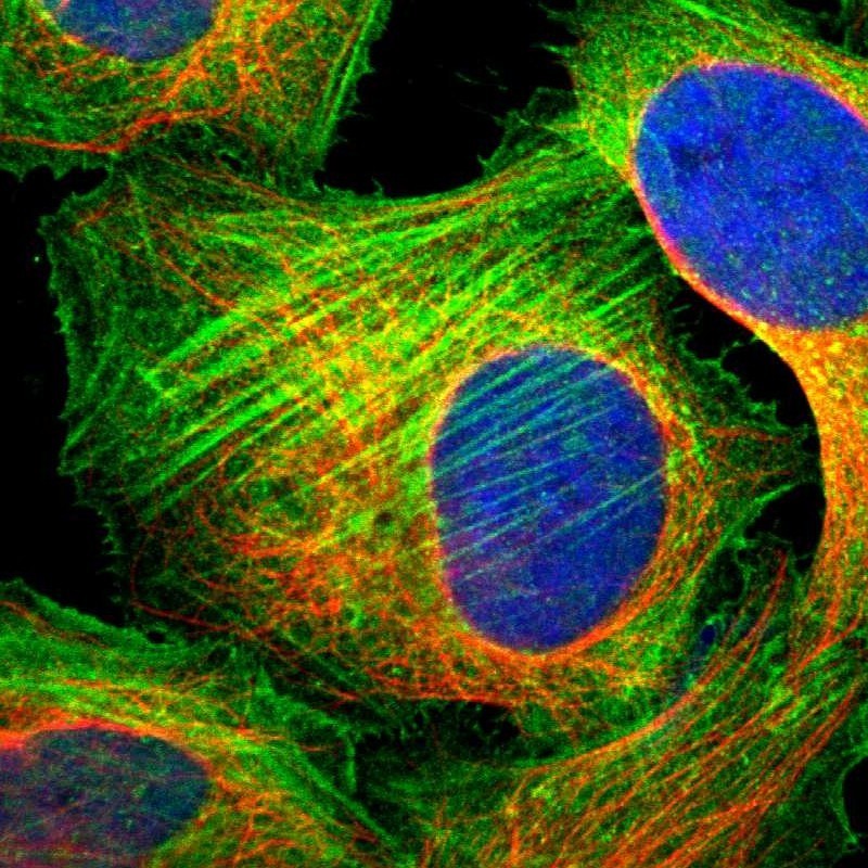 Myosin Phosphatase 2 Antibody-Immunocytochemistry-Immunofluorescence-NBP1-87750-img0004.jpg