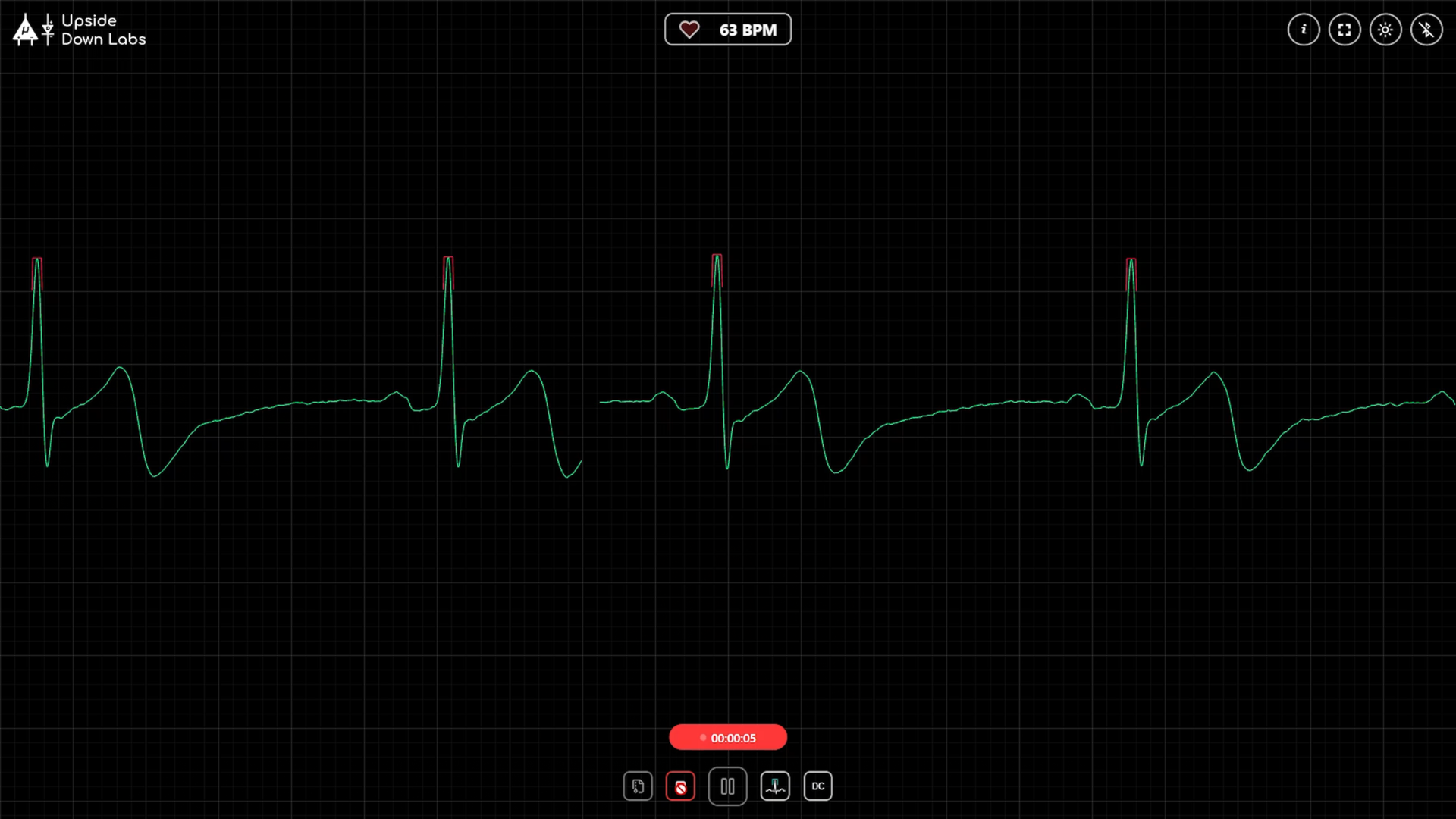 NPG CARDIO SCREEN RECORDING (2).png
