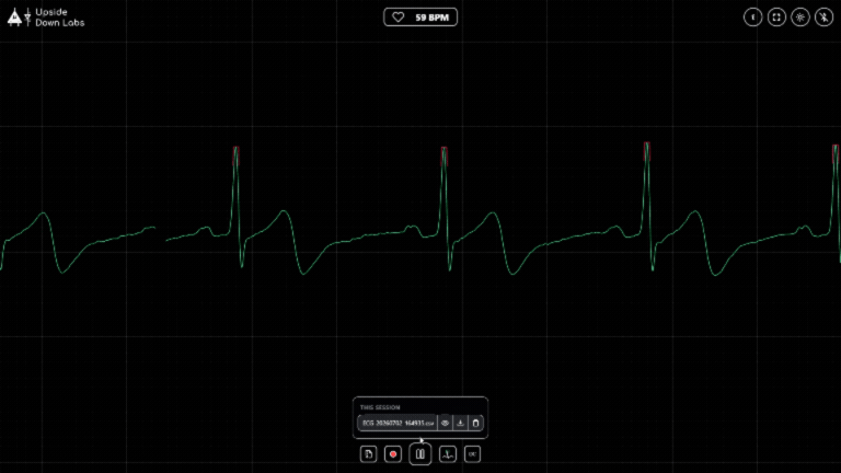 NPG CARDIO SCREEN RECORDING (3).gif