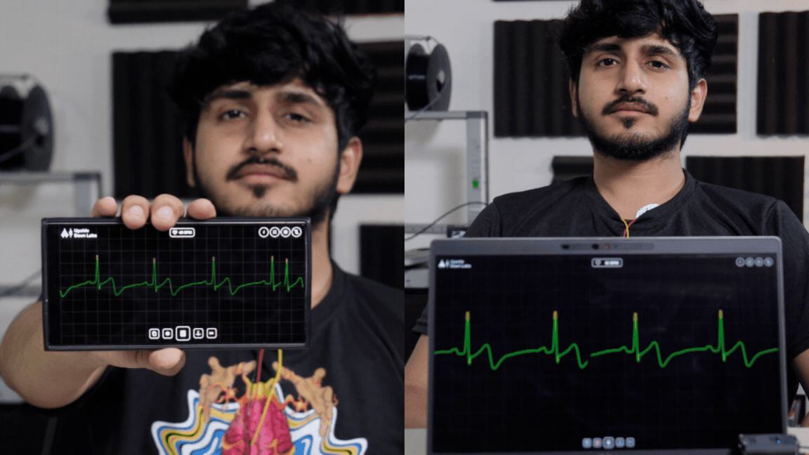 NPG CARDIO SCREEN RECORDING (4).gif