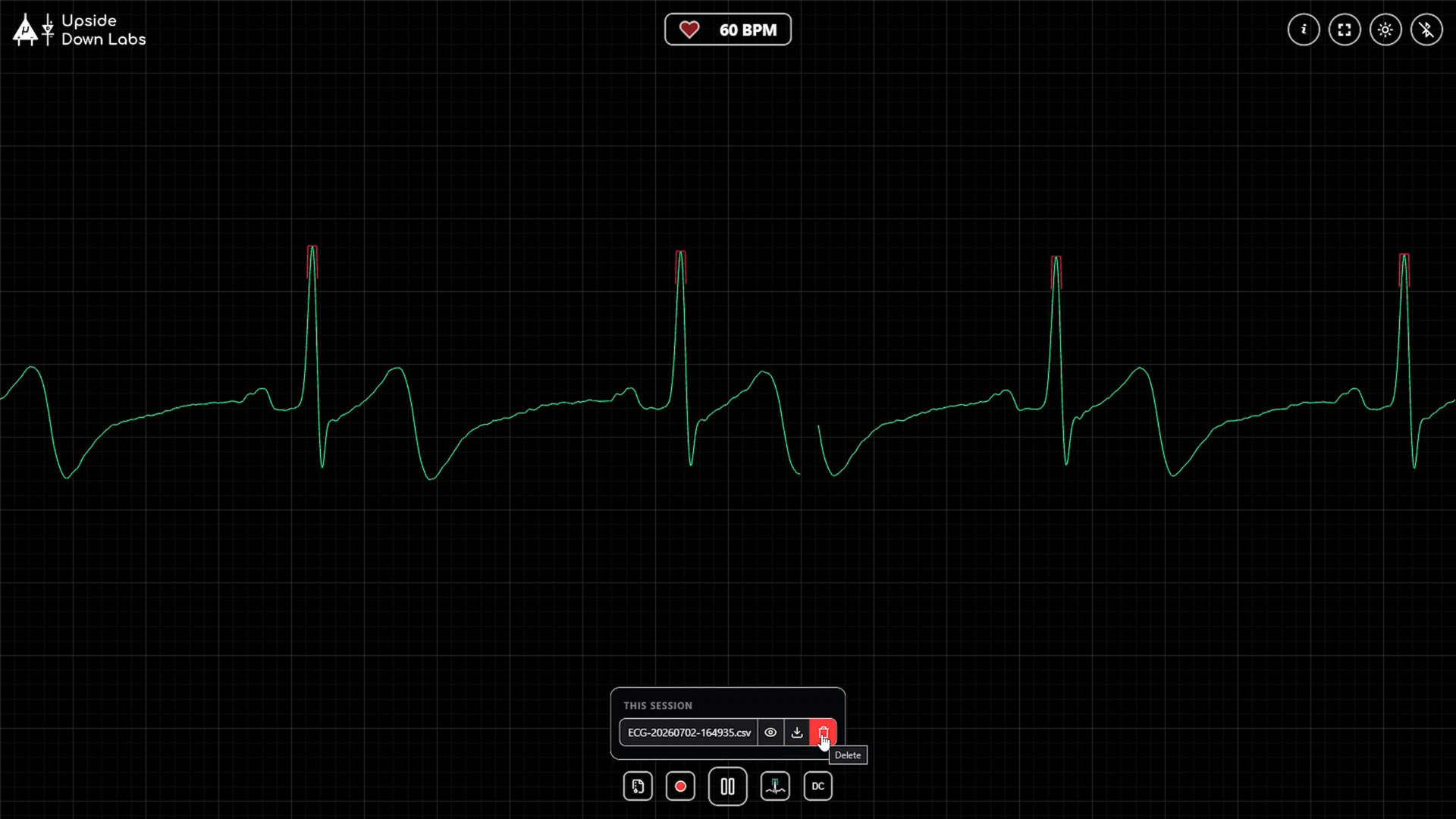 NPG CARDIO SCREEN RECORDING (4).png
