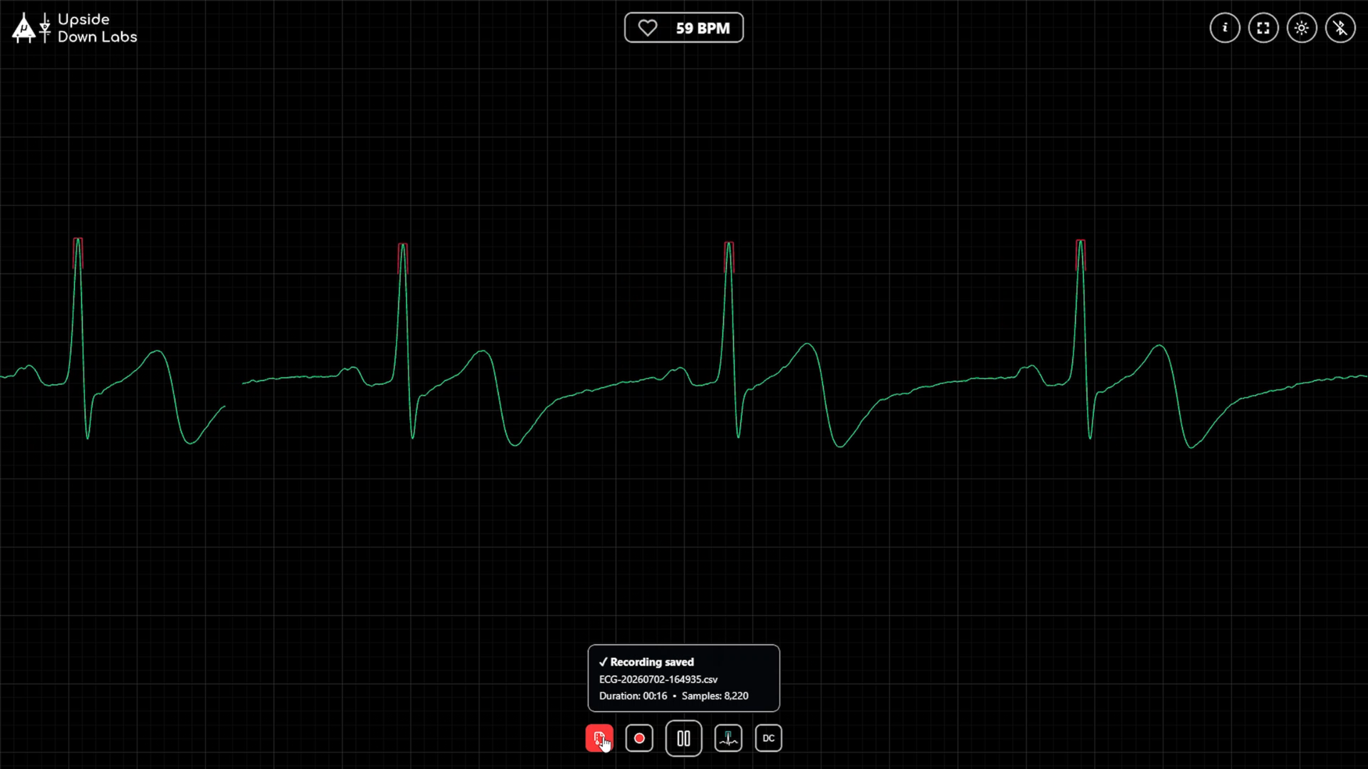 NPG CARDIO SCREEN RECORDING (5).png