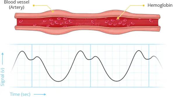 Pulse-Detection-Heart-Rate-Sensor-Working-Photoplethysmogram.jpg