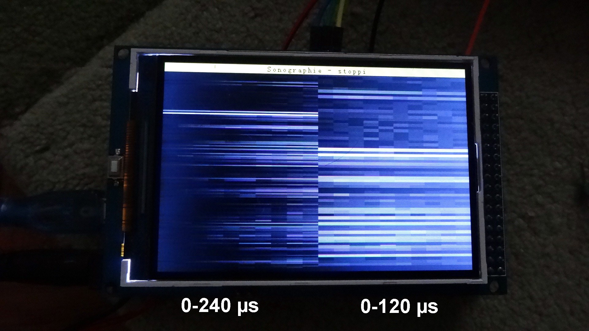 Sonographie_Arduino_120.JPG