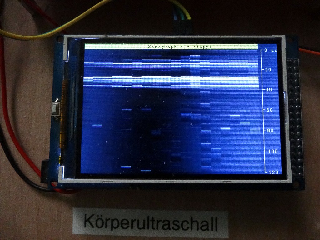 Sonographie_Arduino_195.jpg