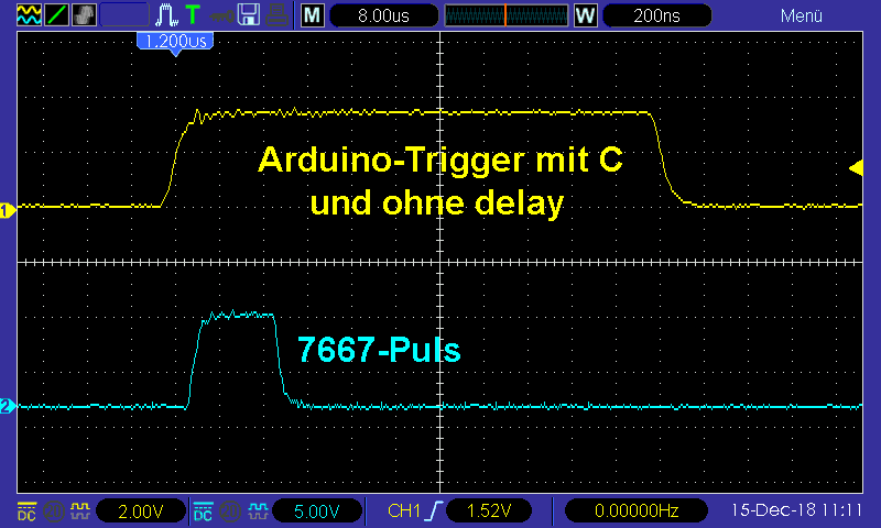 Sonographie_Arduino_206.bmp