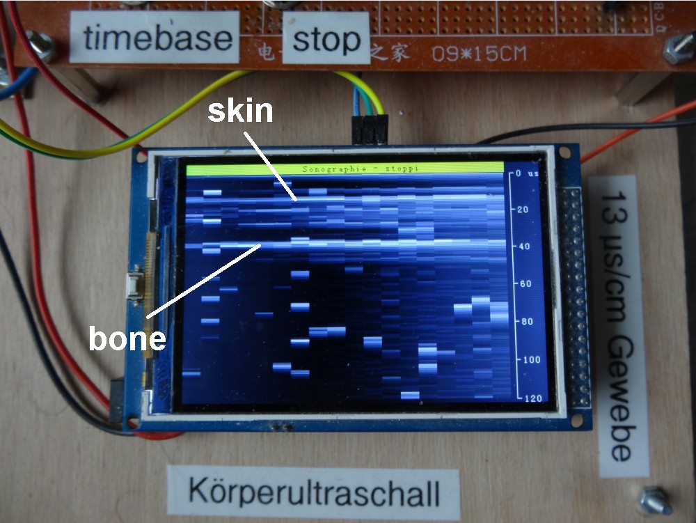 Sonographie_Arduino_215.jpg