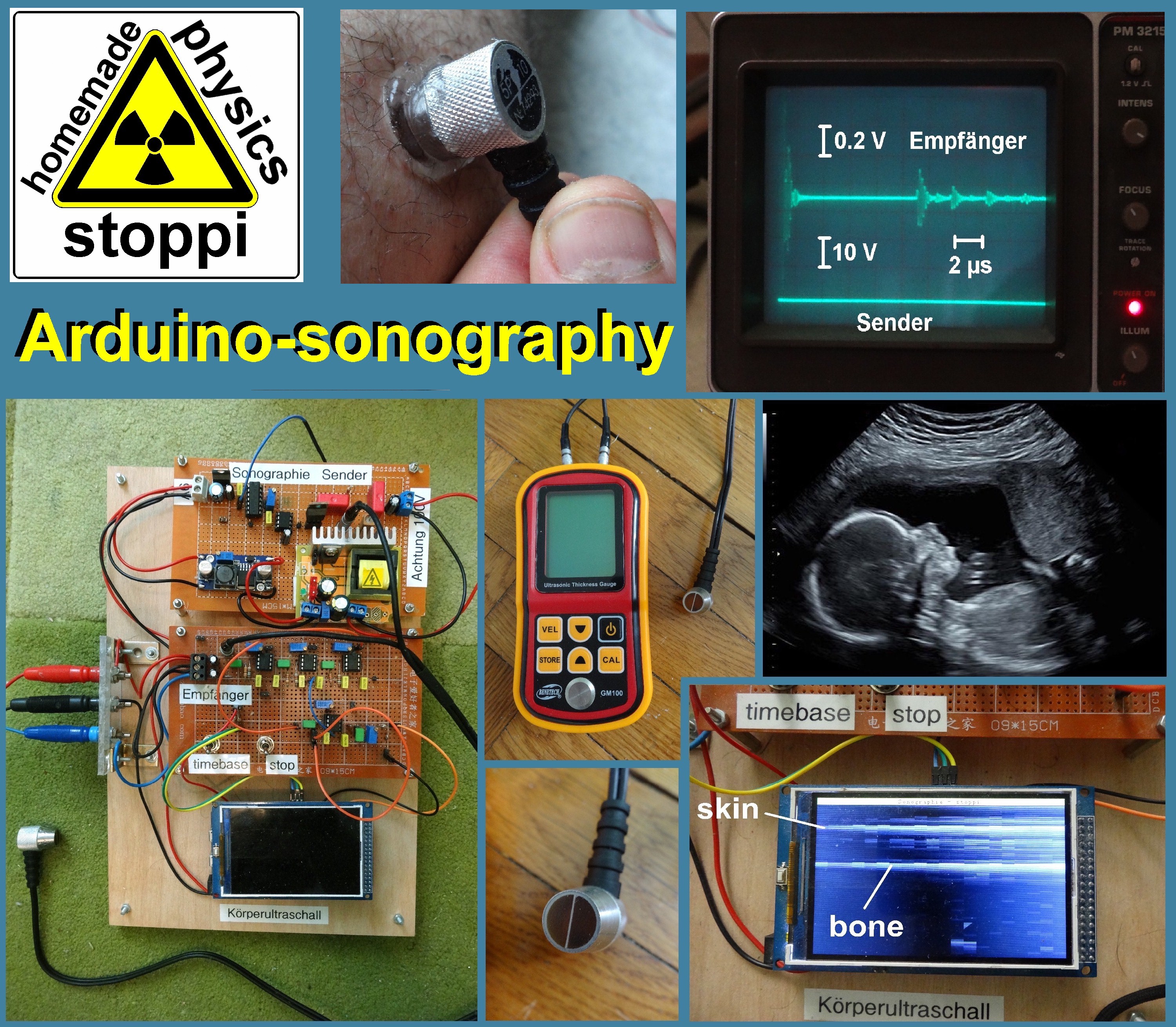 Sonographie_Arduino_220.jpg