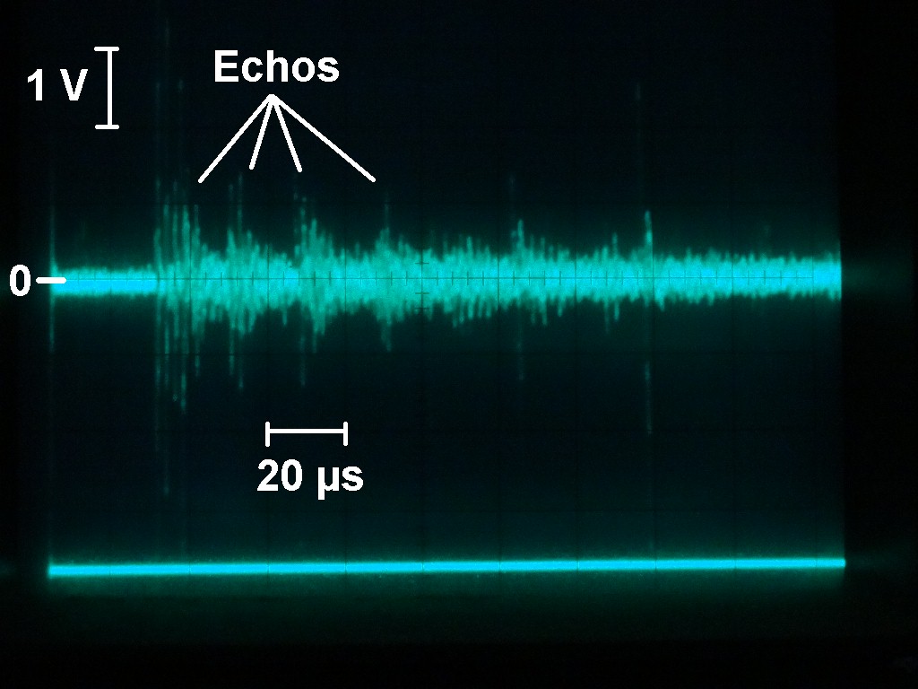 Sonographie_Arduino_82.JPG