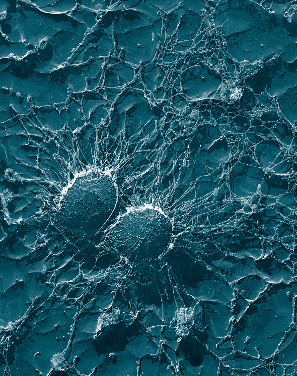 Staphylococcus_aureus,_50,000x,_USDA,_ARS,_EMU.jpg