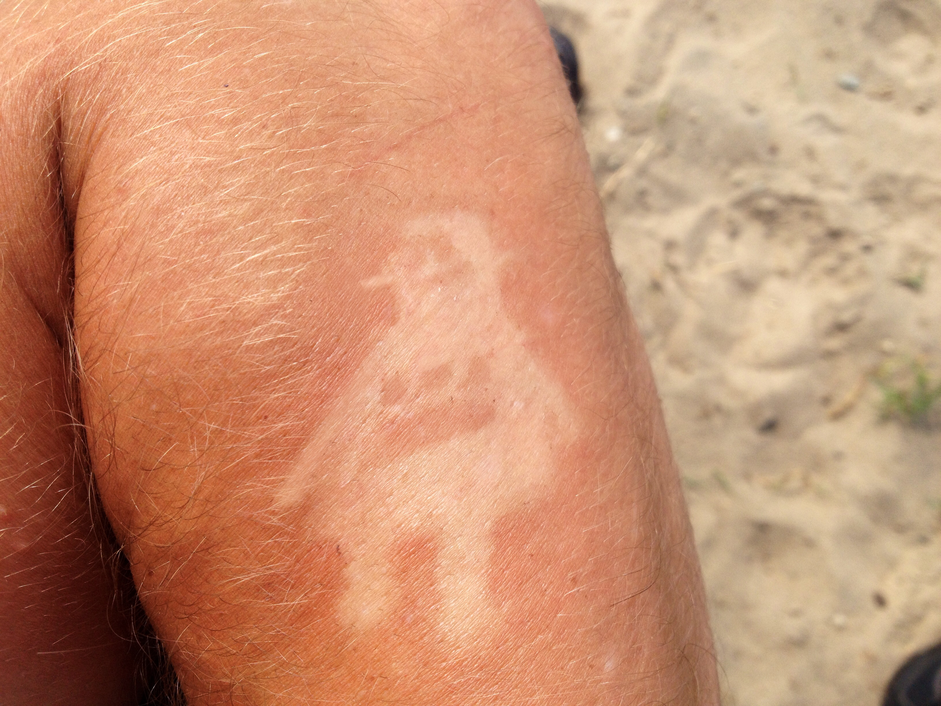 Suntan Tattoo.jpg