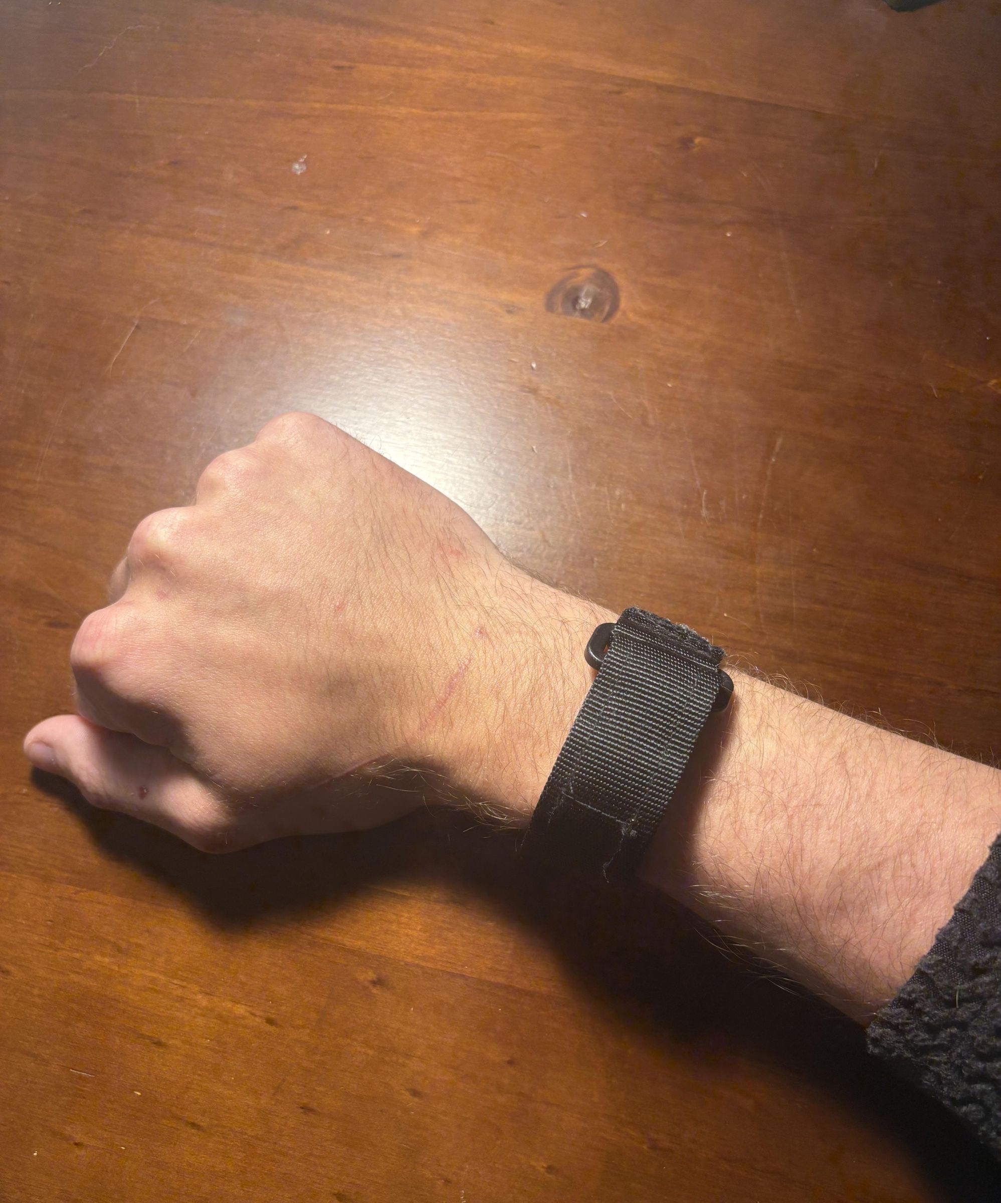 Wrist.jpg