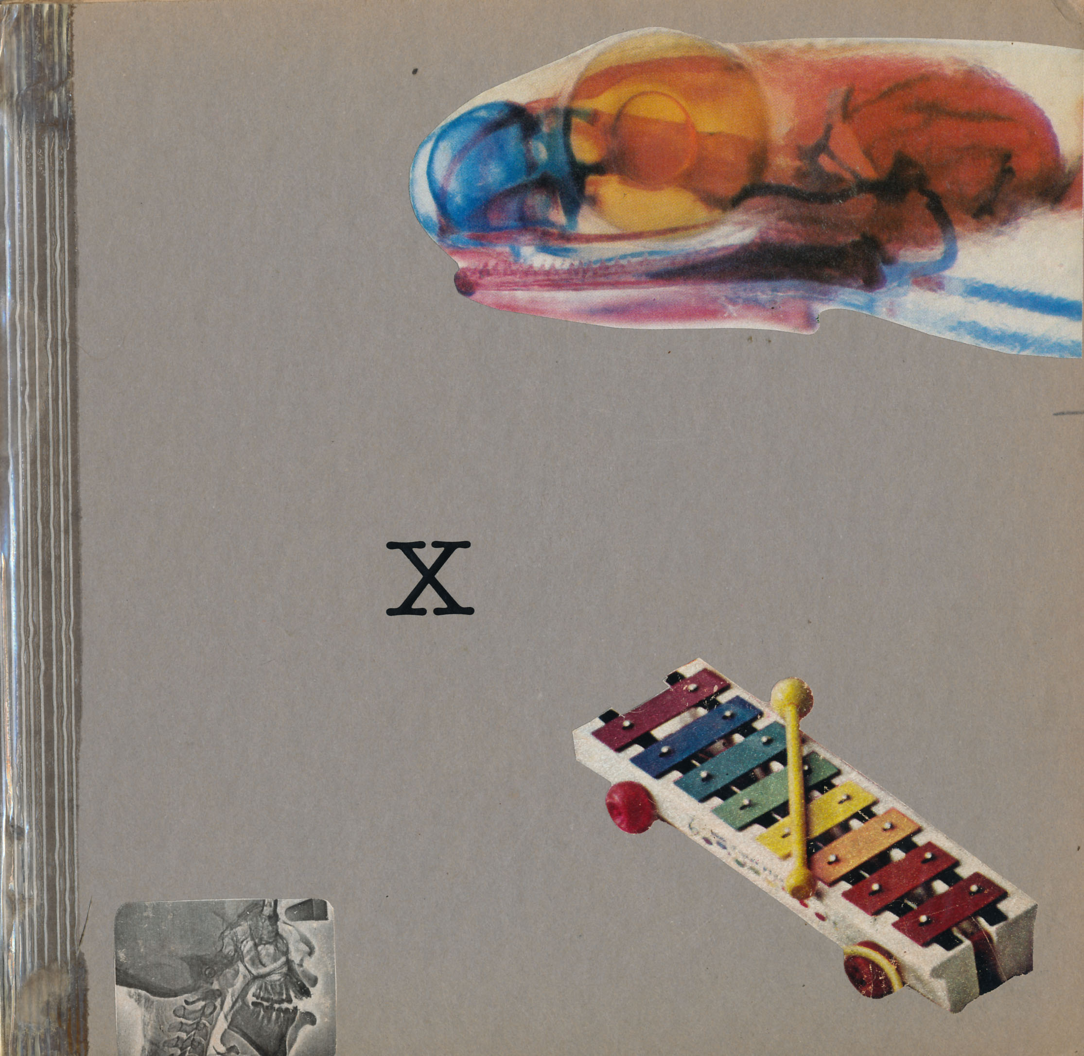 X-ray.jpg