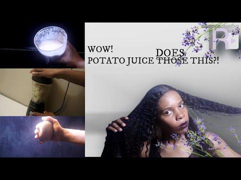 You Will Be Amazed | The Benefits Of Potato Juice In Hair |