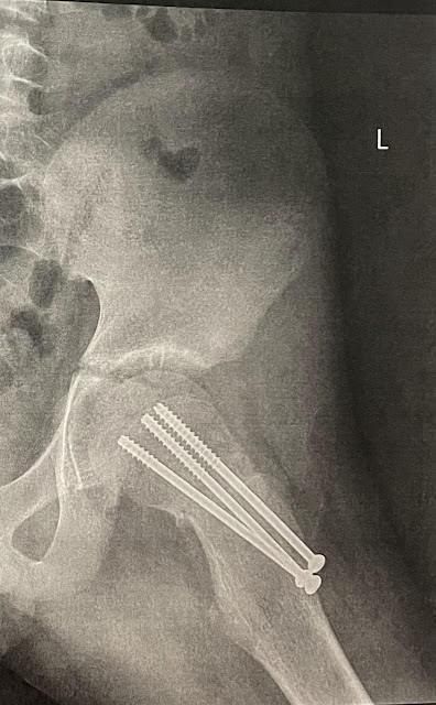 bone 1 (1).jpg