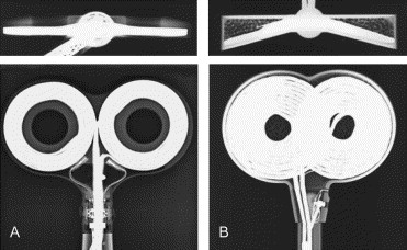 coil_x_rays.jpg