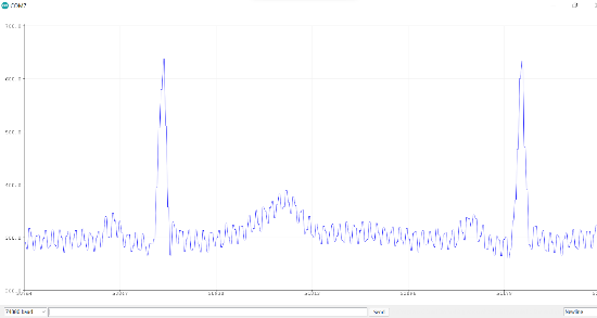 ekg output.png