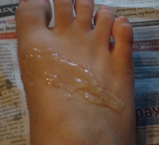 foot gel.jpg