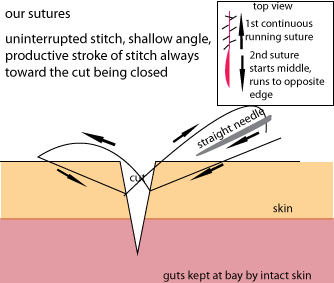 my_modified_sutures.png