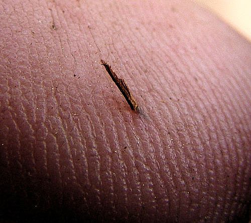 splinter.jpg