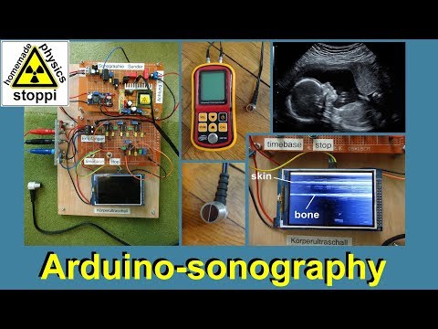 ultrasonic body sonography with arduino - part 2