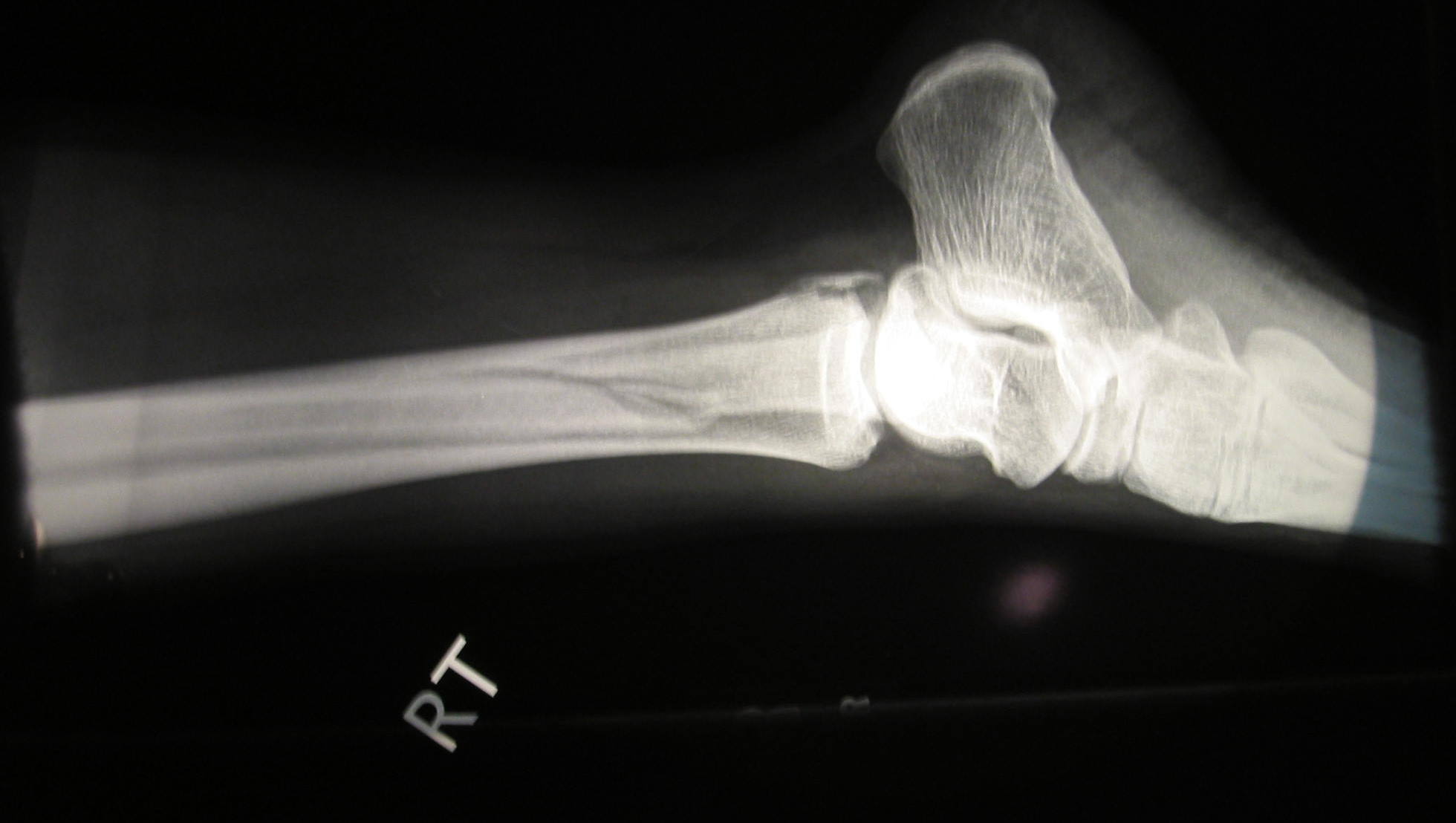 xray_side_crop_IMG_0974.JPG