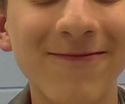 How to Smile