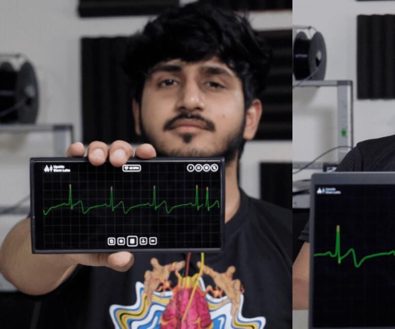 Monitor ECG Anywhere