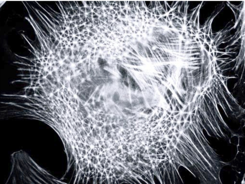 actin-geodome-structures-tensegrity-form-in-cells-as-they-attach-to-a-surface-as-shown-in-this-fluorescence-micrograph-of-actin-in-an-adherent-epithelial-cell.jpg